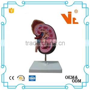 V-AM021 Kidney Model thumbnail-1