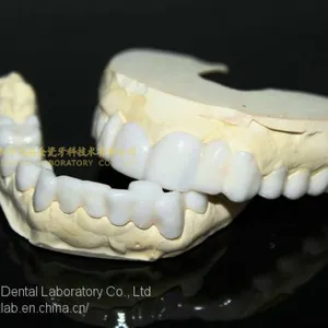 Dental PETG Clip on Veneers, Snap-on-veneers, Smile Veneers, Laboratoire Dentaire, Dentallabor, Laboratorio Dental, Dental Laboratory, Shenzhen LJ Dental Lab China thumbnail-4