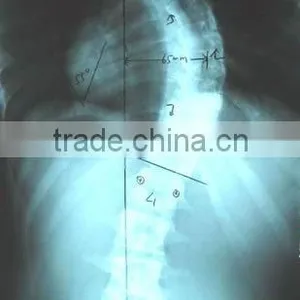 Medical Thermal x Ray Film,blue Sexy Film ,medical Lab Analyzers thumbnail-1