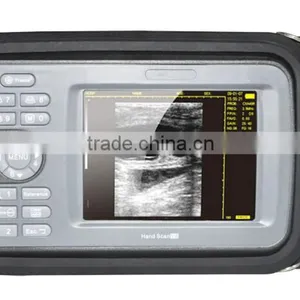 Carejoy Handheld Ultrasound Scanner HandScan H8 With 3.5 Mhz Convex Probe Suitable Carry/transporation Good Price thumbnail-3