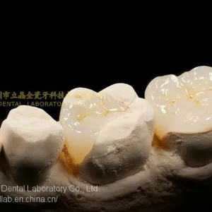 Dental Crown E.Max Ceramic, Porcelain Crown, Dental Veneers, Laboratoire Dentaire, Dentallabor, Laboratorio Dental, Dental Laboratory, Shenzhen LJ Dental Lab China thumbnail-1