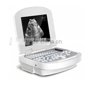 CE Approved Laptop Portable Ultrasound Scanner With 3.5Mhz Multi-frequency 96-element Convex Probe RUS-2000 thumbnail-1
