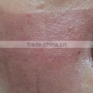 ER Yag Laser Acne Treatment Scar Removal Machine Erbium Laser Remove Chloasma CO2 Laser thumbnail-6