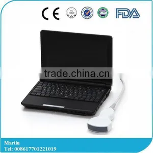 Handheld PC Platform 3D Workstation Ultrasound Scanner With Convex Linear Micro-convex Transvaginal Probe Optional thumbnail-1