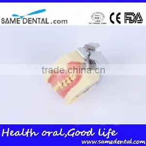 Dental Moderate Periodontal Disease Model Teaching Demonstration thumbnail-4