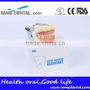 Dental Moderate Periodontal Disease Model Teaching Demonstration thumbnail-6
