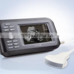 Carejoy Handheld Ultrasound Scanner HandScan H8 With 3.5 Mhz Convex Probe Suitable Carry/transporation Good Price thumbnail-2