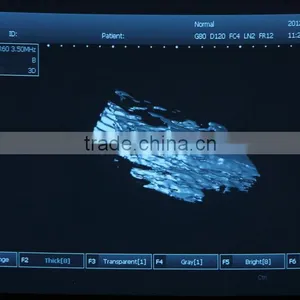 Vet Used 3D Full Digital Portable Ultrasound Scanner Suitable for the Big Animals and Small Animals thumbnail-3