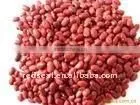 Chinese Small Red Kidney Beans thumbnail-1