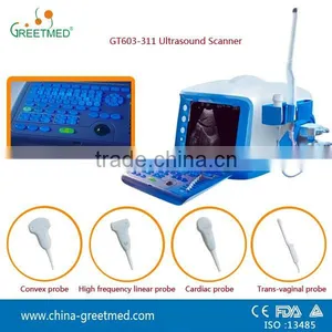 Cheap Price China Portable Ultrasound Scanner thumbnail-1