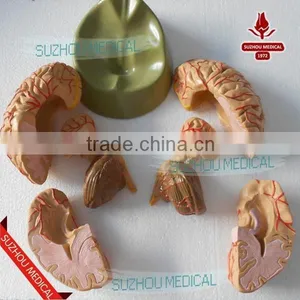Distribution of Brain and Cerebral Arteries thumbnail-4