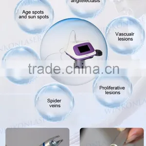2016 Professional Portable Device 980nm Spider Vein Skin Tag Removal Machine Vascular Remover thumbnail-4