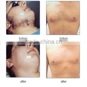 Portable Ipl Elight Hair Removal Skin Rejuvenation Beauty Machine thumbnail-4