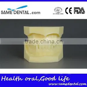 Malocclusion Classification Demonstration Model 2 thumbnail-1