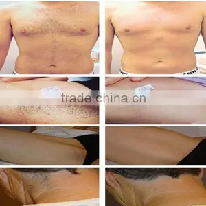 Beijing Sincoheren SMQ-NK IPL Hair Removal & Skin Rejuvenation Equipment thumbnail-3