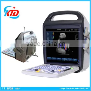 2016 New 3D 4D Color Doppler Ultrasound Machine With CFM, PW, CDE, CCD, HPRF Modes Quality Choice Supplier's Ch thumbnail-1