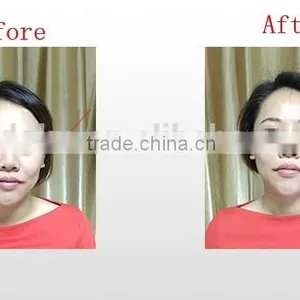 Small Machines to Make Money Face Lifting Machines Thermal rf Beauty Equipment thumbnail-3