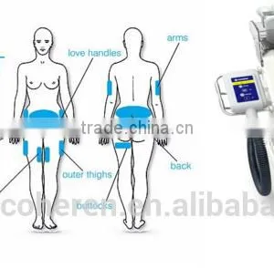 Cool Cellulite Removal Machine Vacuum Body Massage Equipment With Cool Fat Cell Freezing Tech thumbnail-5