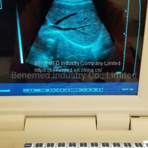 Notebook Type Black and White Ultrasound Scanner Medical Equipment thumbnail-2