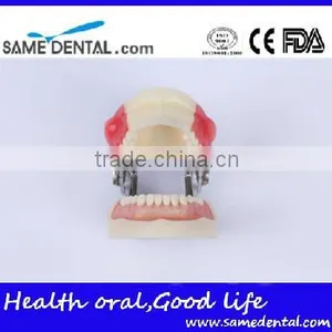 Abscess and Tooth Preparation Model School Teaching Demonstration thumbnail-3