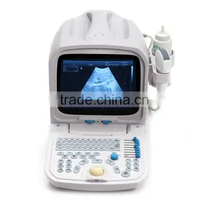 18 Months Warranty Black and White Images Digital Low Price Laptop Ultrasound Machine thumbnail-3