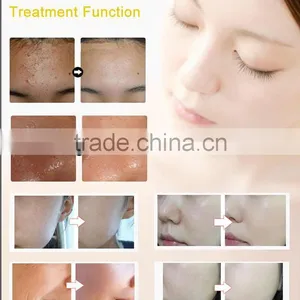 3 Colors LED Mask!! Face Lifting LED Facial Mask From China thumbnail-6