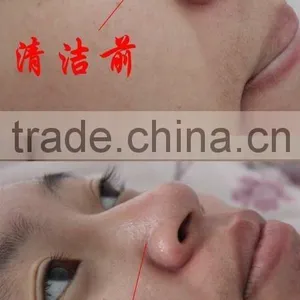 New Updated Exfoliators Machine Water Microdermabrasion/facial Cleaning Brush thumbnail-5