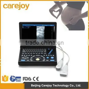 Full Digital Laptop Ultrasound Scanner (PC System) With CE & ISO Certificate thumbnail-1