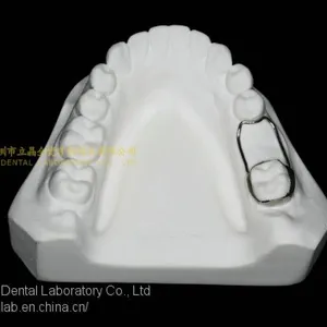 Space Expanders, Nance Appliance, Helix Appliance, Pendulum Appliance, ﻿﻿﻿﻿Porter Appliance, Fixed Lingual Expander, Sagittal Screw Appliance, Hyrax Rapid Palatal Expander, Orthodontic Retainers, Dental Orthodontic Appliance, Laboratoire Dentaire, Dentall thumbnail-2