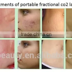 Speckle Removal Skin Regeneration Portable 10600nm CO2 Fractional Age Spot Removal Laser Equipment For Scar Removal/handheld Co2 Laser 40w thumbnail-6