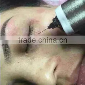 High Frequency Spot Removal Pen Speckle Removal thumbnail-3