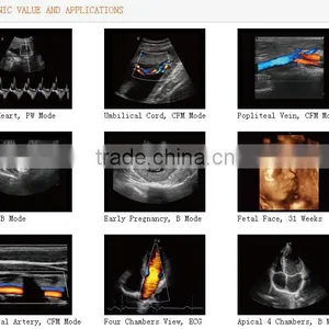 Trolley 3D/4D Color Doppler Ultrasound Diagnostic System I3 With CE Certificate thumbnail-2