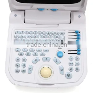 2016 Promotion!!CE Approved Portable Ultrasound Scanner With 3.5Mhz Multi-frequency Convex Probe RUS-9000A thumbnail-2