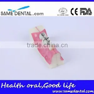 Right Tooth Tissue Decomposition Model Dental Eduction Assitant No. DEA-17 thumbnail-2