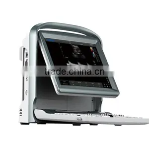 Medical Equipment 18 Months Warranty Ultrasound Machine Color Doppler With Trolley thumbnail-2