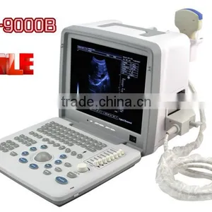 Sale Portable Ultrasound Scanner With Convex Probe for Detecting Gynecology Obstetrics Etc thumbnail-1