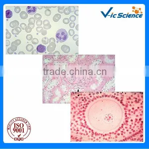 Hemopathy Prepared Microscope Glass Slides for Teaching and Lab Survey thumbnail-1