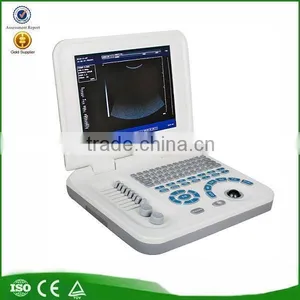 RUS-9000F2 CE&ISO Easy Carrying Portable Ultrasound Scanner Price thumbnail-1