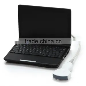 Clear Image Laptop Type Ultrasound Scanner System Full Digital Machine in Transport Carriage thumbnail-5