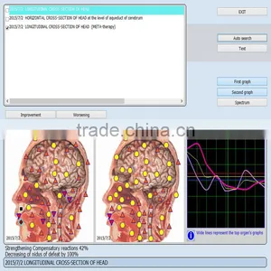 2017 Composition Analyze Equipment 9D NLS Sub-health Detector Best 9d Nls Diagnostic Scanner thumbnail-4