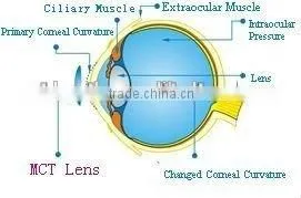 China MCT-A/High-end MCT Technology For Child Amblyopia thumbnail-4