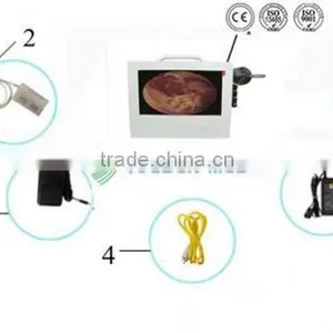 China Manufacturer Veterinary Devices Ent Camera thumbnail-2