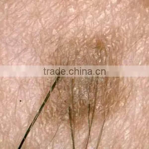 Portable Skin and Hair Analyzer Machine thumbnail-3
