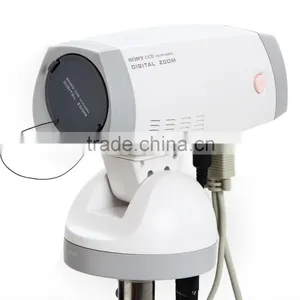 Electronic Colposcope RCS-500-Shelly thumbnail-2