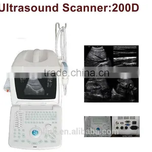 Super LINK Supply Digital Portable Ultrasound Scanner thumbnail-3