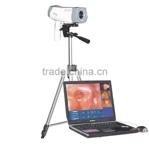 Electronic Colposcope RCS-400 Cheap Price Color Digital CCD Sony Camera thumbnail-1