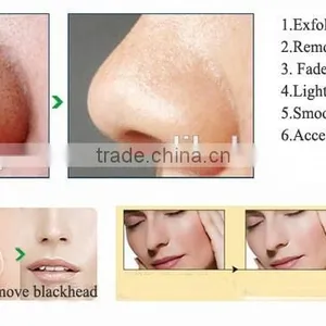 2017 Factory Price Vacuum Blackhead Remover, Amazon Beauty Salon Equipment thumbnail-1