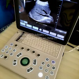 Ultraslim Notebook Type Black and White Ultrasound Scanner Machine thumbnail-2
