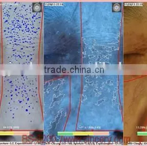 Portable Facial Skin Scanner Analyzer 3D Facial Skin Analysis thumbnail-3