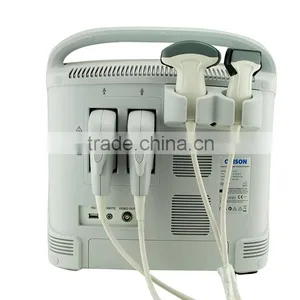 China Cheap Price USB Portable Laptop Color Doppler Ultrasound Scanner for Pregnancy Scanner Ultrasound thumbnail-6